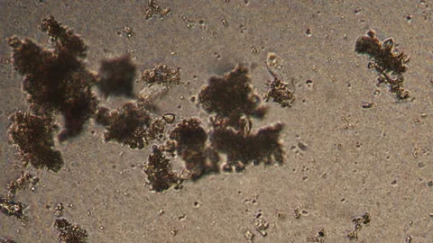 Microscopy of Amoeba limax in the water (pond) sample. Magnification 300x microo Stock Footage 123493799