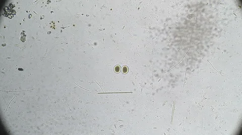 Microscopy, Bipartition cell. Reproduction Stock Footage 68786630