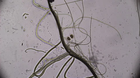 Microscopy, Bipartition cell. Reproduction Stock Footage 68787247