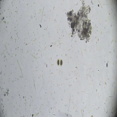 Microscopy: Bipartition cell. Reproduction Stock Footage 69502382