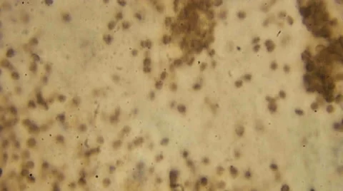 Microscopy [blood] 4 Stock Footage 65236159