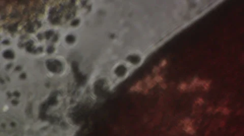 Microscopy [blood cells] Stock Footage 37628863