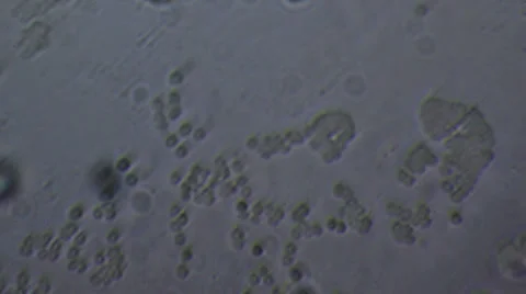 Microscopy [blood cells] Stock Footage 37648968