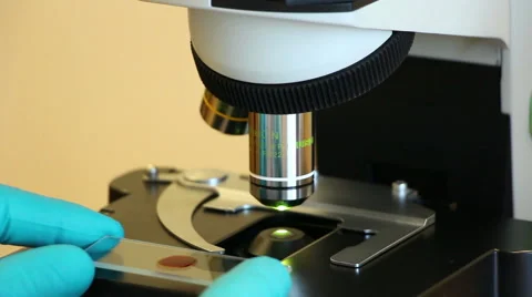 Microscopy of the blood sample Stock Footage 63045840