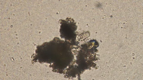 Microscopy of ciliary ciliates (Cothurnia sp.) in the water sample. Infusoria at Stock Footage 123484089