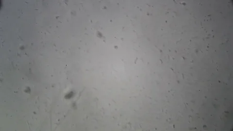 Microscopy: Cultivation. Different bacterial colonies Stock Footage 82686175