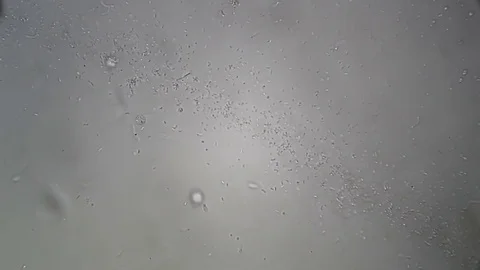 Microscopy: Cultivation. Different bacterial colonies Stock Footage 82686243