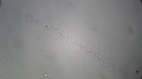 Microscopy: Cultivation. Different bacterial colonies Stock Footage 82686307