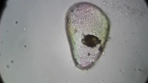 Microscopy: Cultivation. Different bacterial colonies Stock Footage 89039035