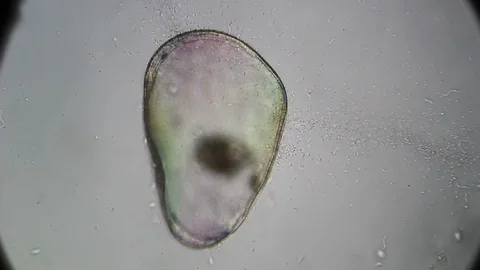 Microscopy: Cultivation. Different bacterial colonies Stock Footage 89039044