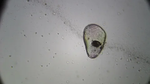 Microscopy: Cultivation. Different bacterial colonies Stock Footage 89039058