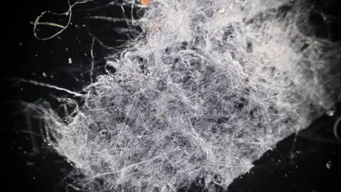 Microscopy: Decaying watermelon cells Stock Footage 117227680