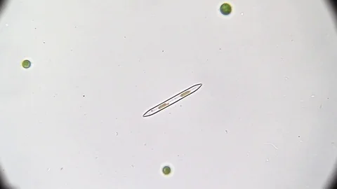 Microscopy: Diatoms SP Stock Footage 80598692