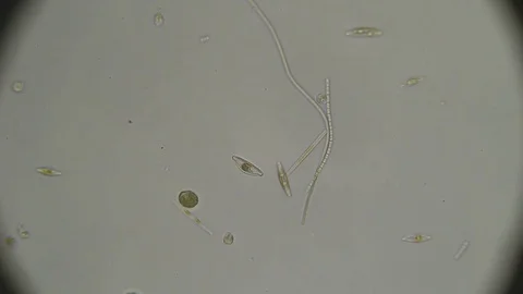 Microscopy: Diatoms SP Stock Footage 80598718