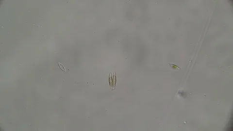 Microscopy: Diatoms SP Stock Footage 80622419
