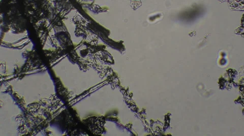 Microscopy [dust specs] Stock Footage 37660569