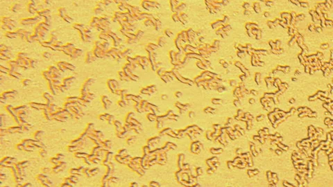Microscopy of human blood cell test. Magnification 150x moving of red blood cell Stock Footage 129428444
