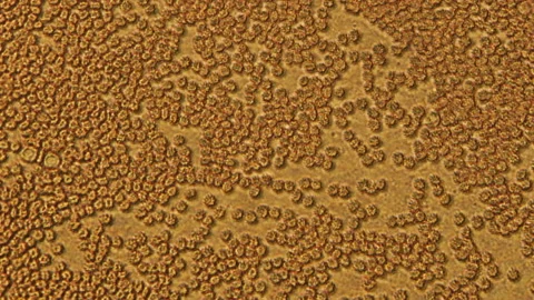 Microscopy of human blood cell test. Magnification 300x moving of red blood cell Video stock 129446222