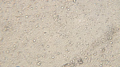 Microscopy of human sperm . Magnification 150x moving of spermatozoides in detai Video stock 127600421