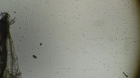 Microscopy: Insect Larva SP Stock Footage 79621915