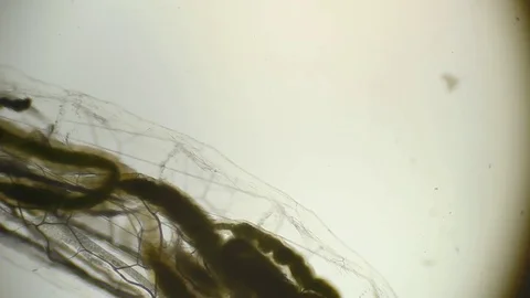 Microscopy: Insect Larva SP Stock Footage 79621933