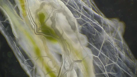 Microscopy: Insect Larva SP Stock Footage 79630653