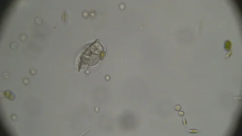 Microscopy: Lepadella Rotifers 動画素材 126749537
