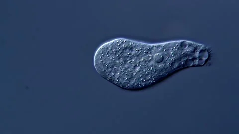 Microscopy - live amoeba in pond water sample 库存影片 310313853