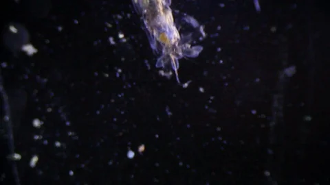 Microscopy - Mosquito Larvae, under the microscope Stock Footage 69862656