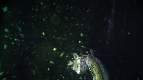 Microscopy - Mosquito Larvae, under the microscope Stock Footage 69862775