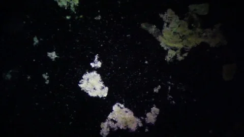 Microscopy - Mosquito Larvae, under the microscope Stock Footage 69863660