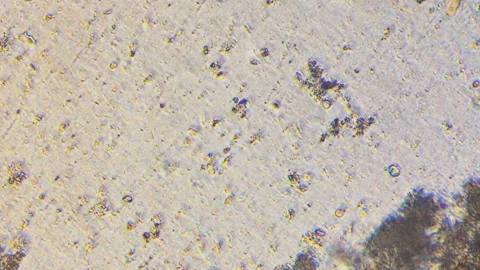 Microscopy of multiple colonies of protozoa and bacteria in the water sample. Ma Stock Footage 122012133