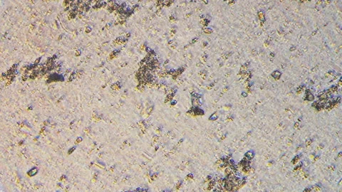 Microscopy of multiple colonies of protozoa and bacteria in the water sample. Ma Stock Footage 122012375