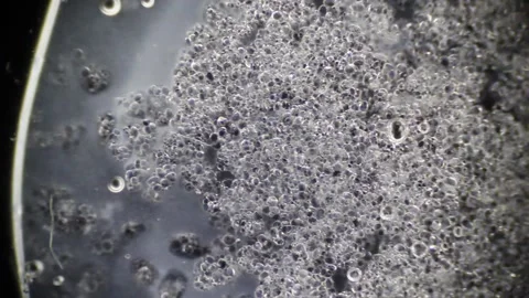 Microscopy: A Ootato Cells Decaying Stock Footage 117228717