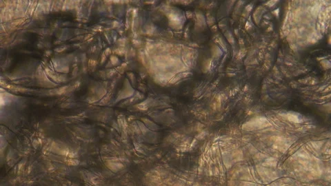 Microscopy of parasite worm nematode (Strongyloides stercoralis). Closeup moveme Video stock 122108808
