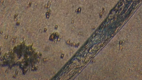 Microscopy of parasite worm nematode (Strongyloides stercoralis). Closeup moveme Video stock 122246184