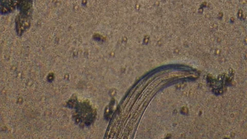 Microscopy of parasite worm nematode (Strongyloides stercoralis). Closeup moveme Video stock 122246259