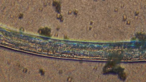 Microscopy of parasite worm nematode (Strongyloides stercoralis). Closeup moveme Video stock 122246323