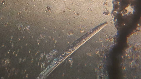 Microscopy of parasite worm nematode (Strongyloides stercoralis). Movement of ac Video stock 122246449