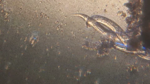 Microscopy of parasite worm nematode (Strongyloides stercoralis). Movement of ac Stock Footage 122246529