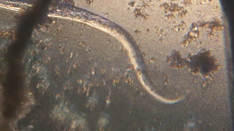 Microscopy of parasite worm nematode (Strongyloides stercoralis). Movement of ac Video stock 122246620