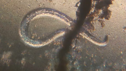 Microscopy of parasite worm nematode (Strongyloides stercoralis). Movement of ac Video stock 122246789