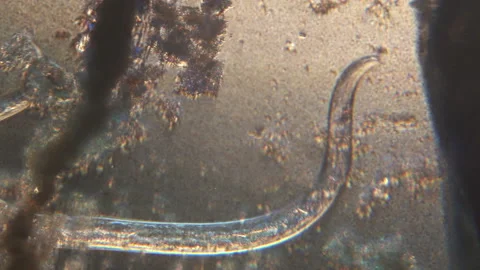 Microscopy of parasite worm nematode (Strongyloides stercoralis). Movement of ac Video stock 122246954