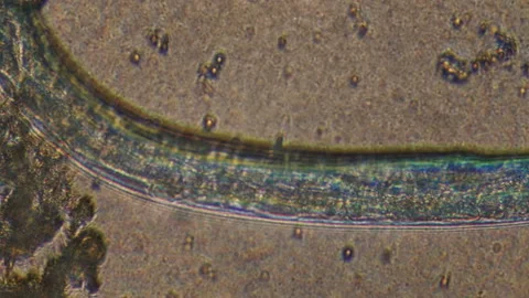 Microscopy of parasite worm nematode (Strongyloides stercoralis). Closeup moveme Video stock 122248610