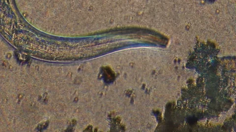 Microscopy of parasite worm nematode (Strongyloides stercoralis). Closeup moveme Video stock 122248660