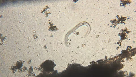 Microscopy of parasite worm nematode (Strongyloides stercoralis). Movement of ac Stock Footage 123471546