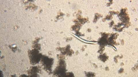 Microscopy of parasite worm nematode (Strongyloides stercoralis). Movement of ac Video stock 123471689