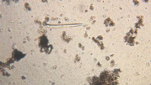 Microscopy of parasite worm nematode (Strongyloides stercoralis). Movement of ac Vídeos de archivo 123471975