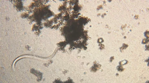 Microscopy of parasite worm nematode (Strongyloides stercoralis). Movement of ac Video stock 123472129