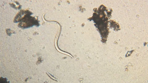Microscopy of parasite worm nematode (Strongyloides stercoralis). Movement of ac Video stock 123472365